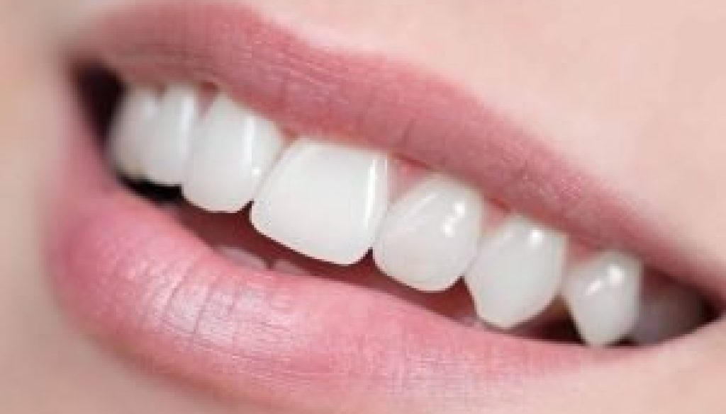 Best Teeth Whitening in St Helens